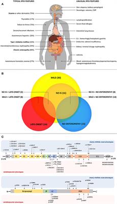 Atypical Presentations of IPEX: Expect the Unexpected